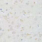 Anti-SLC2A13 antibody used in IHC (Paraffin sections) (IHC-P). GTX65995