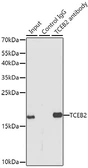 Anti-Elongin B antibody used in Immunoprecipitation (IP). GTX66010