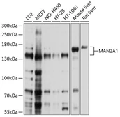 Anti-MAN2A1 antibody used in Western Blot (WB). GTX66054
