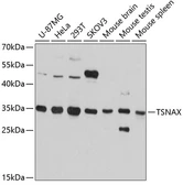 Anti-TRAX antibody used in Western Blot (WB). GTX66095