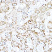 Anti-Kaiso antibody used in IHC (Paraffin sections) (IHC-P). GTX66129