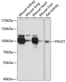 Anti-PALD1 antibody used in Western Blot (WB). GTX66135
