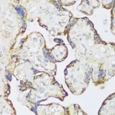 Anti-ECH1 antibody used in IHC (Paraffin sections) (IHC-P). GTX66141