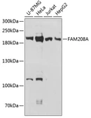 Anti-FAM208A antibody used in Western Blot (WB). GTX66177