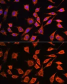 Anti-MRPL45 antibody used in Immunocytochemistry/ Immunofluorescence (ICC/IF). GTX66181
