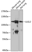 Anti-LLGL2 antibody used in Western Blot (WB). GTX66189