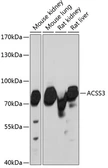 Anti-ACSS3 antibody used in Western Blot (WB). GTX66206