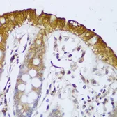 Anti-GCC2 antibody used in IHC (Paraffin sections) (IHC-P). GTX66210