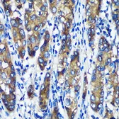 Anti-ERp19 antibody used in IHC (Paraffin sections) (IHC-P). GTX66255