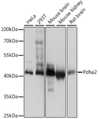 Anti-PDHA2 antibody used in Western Blot (WB). GTX66319