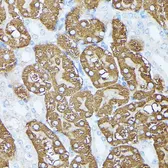 Anti-PLS1 antibody used in IHC (Paraffin sections) (IHC-P). GTX66355