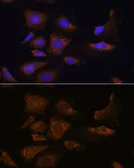 Anti-RPS25 antibody used in Immunocytochemistry/ Immunofluorescence (ICC/IF). GTX66357