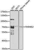 Anti-ICB1 antibody used in Western Blot (WB). GTX66365