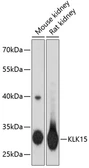 Anti-Kallikrein 15 antibody used in Western Blot (WB). GTX66419