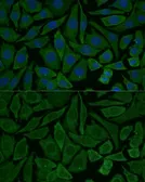 Anti-NDUFB2 antibody used in Immunocytochemistry/ Immunofluorescence (ICC/IF). GTX66430