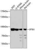 Anti-IFT81 antibody used in Western Blot (WB). GTX66452