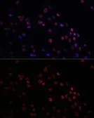 Anti-MATR3 antibody used in Immunocytochemistry/ Immunofluorescence (ICC/IF). GTX66470