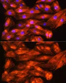 Anti-ZCCHC11 antibody used in Immunocytochemistry/ Immunofluorescence (ICC/IF). GTX66474