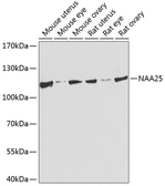 Anti-NAP1 antibody used in Western Blot (WB). GTX66529
