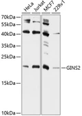 Anti-PSF2 antibody used in Western Blot (WB). GTX66559