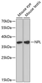Anti-NPL antibody used in Western Blot (WB). GTX66561