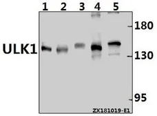Anti-ULK1 antibody used in Western Blot (WB). GTX66612