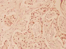 Anti-Fas Ligand antibody used in IHC (Paraffin sections) (IHC-P). GTX66619