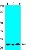 Anti-TIMP1 antibody used in Western Blot (WB). GTX66643