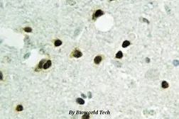 Anti-Histone H2B antibody used in IHC (Paraffin sections) (IHC-P). GTX66686