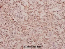 Anti-Arylsulfatase F antibody used in IHC (Paraffin sections) (IHC-P). GTX66710