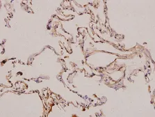 Anti-PDGFA antibody used in IHC (Paraffin sections) (IHC-P). GTX66716
