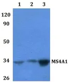 Anti-CD20 antibody used in Western Blot (WB). GTX66791
