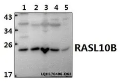 Anti-RASL10B antibody used in Western Blot (WB). GTX66819