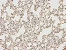Anti-IL6 antibody used in IHC (Paraffin sections) (IHC-P). GTX66828