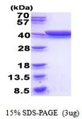 GldA protein, His tag (active). GTX66892-pro