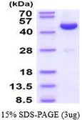 Human Adenosine kinase protein, His tag (active). GTX66903-pro