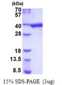 Mouse Akr1b1 protein, His tag (active). GTX66909-pro