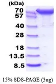 Human ERP72 protein, His tag (active). GTX66987-pro