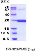 Mouse GSTP1 protein, His tag (active). GTX67041-pro