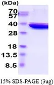 Rat LDHA protein, His tag (active). GTX67083-pro