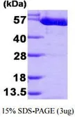 Human PKM protein, His tag (active). GTX67124-pro