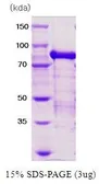 Human PRMT1 protein, His and MBP tag. GTX67137-pro