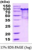 Mouse PRMT1 protein, His and MBP tag (active). GTX67138-pro