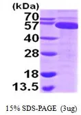 Human TrxR1 protein, His tag (active). GTX67176-pro