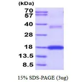 Mouse VEGFA protein, His tag (active). GTX67184-pro