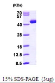 Human ACAT2 protein, His tag. GTX67189-pro