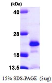 Human NUDT2 protein, His tag. GTX67224-pro