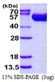 Human ASL protein, His tag. GTX67238-pro