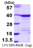 Human EEF1D protein, His tag. GTX67367-pro