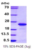 Human FGF12 protein, His tag. GTX67391-pro